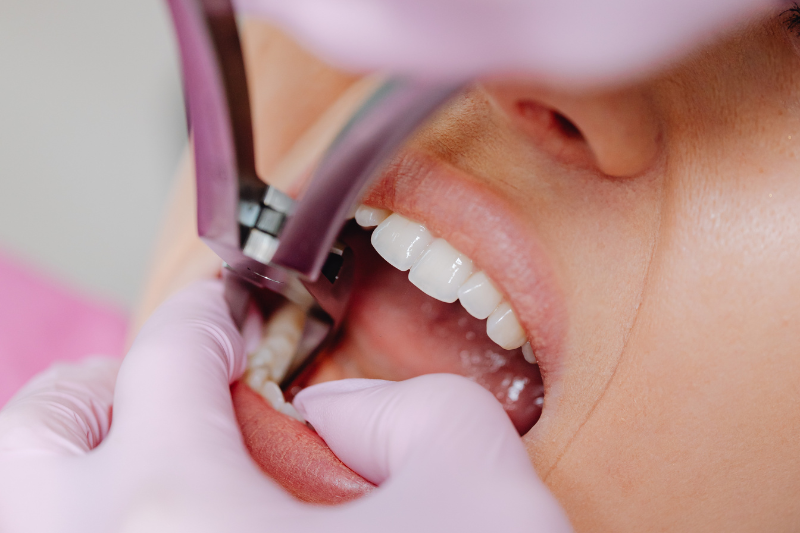 crescimento-dos-planos-odontologicos-e-impulsionado-e-alcanca-novo-patamar