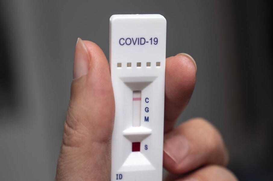 teste-rapido-de-covid-19-entra-no-rol-de-coberturas-obrigatorias